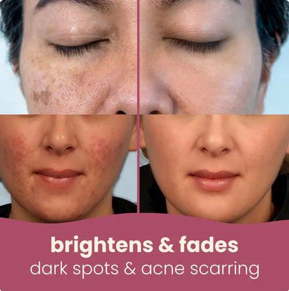 Kojic Acid & Turmeric Cleansing Pads
